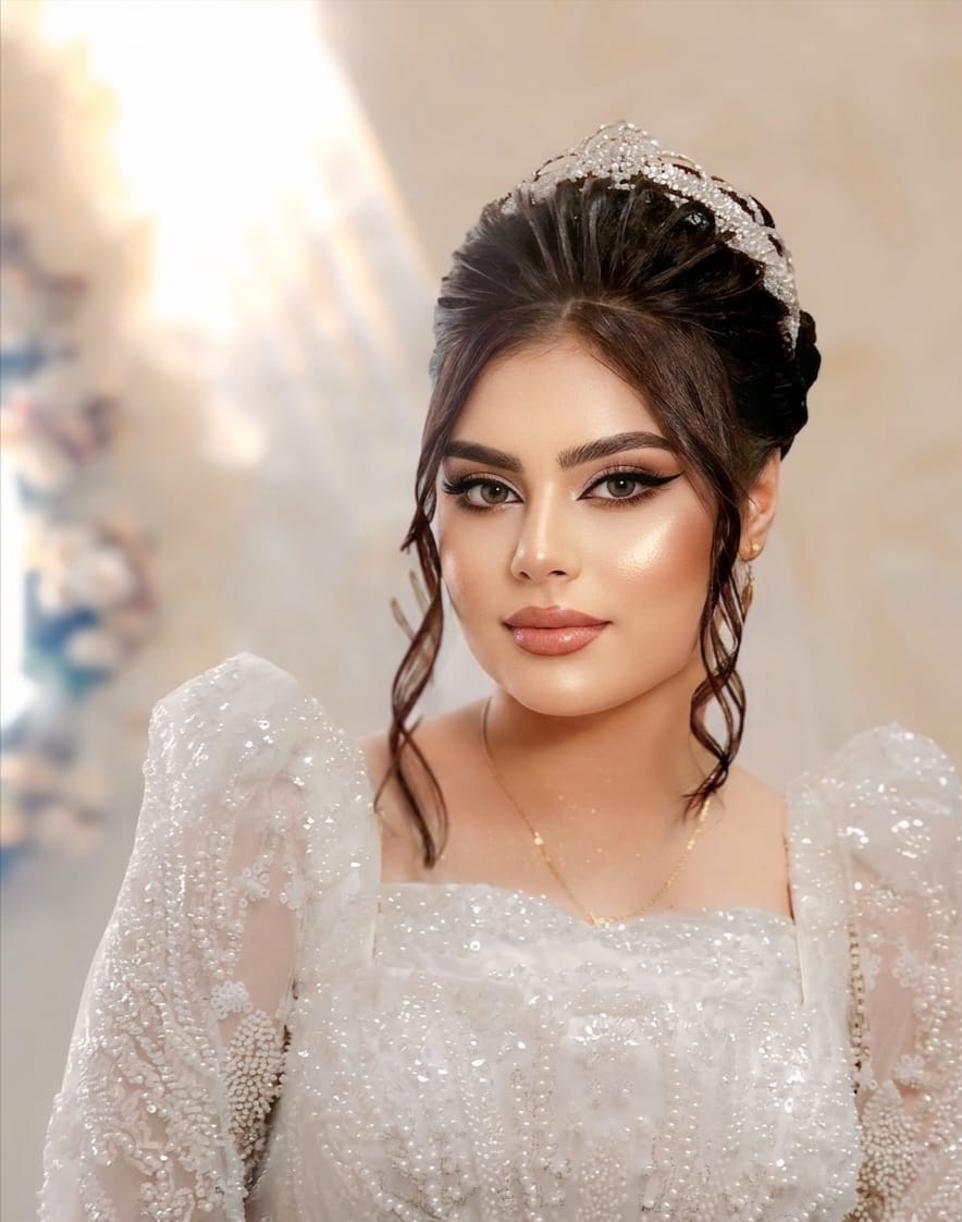 صورة 1 من فينيرا