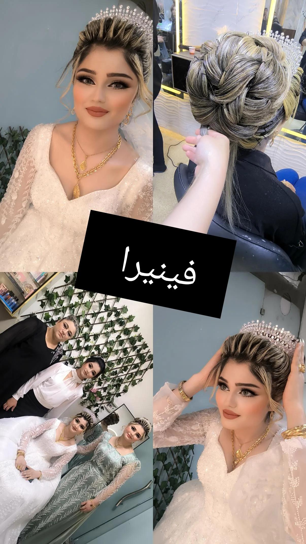 صورة 4 من فينيرا